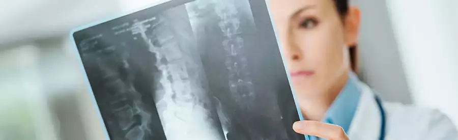 doctor looking at xray